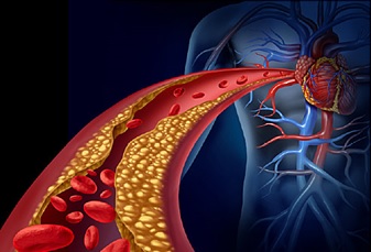 تشخیص حمله قلبی و سندرم حاد کرونری 