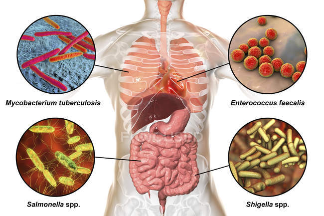 میکروبیم در بیماری‌های خود ایمن روماتوئیدی (بخش دوم)