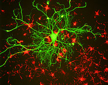 نقش بالینی نوروفیلامنت ها در تشخیص بیماری های مغز و اعصاب