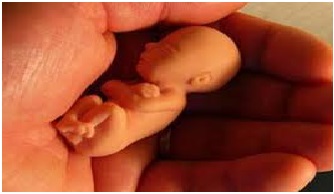نقش پلی مورفیسم ژن های ترومبوفیلیا در افزایش خطر سقط مکرر 