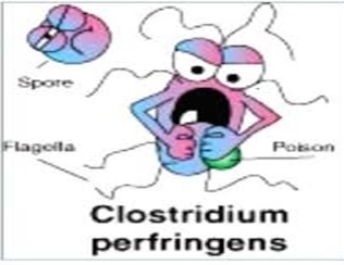 عفونت Clostridium perfringens (جوانه کافه تریا)