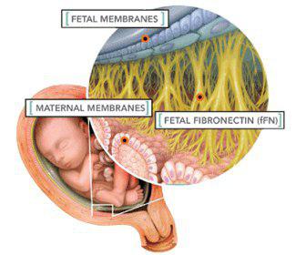  آزمایش فیبرونکتین جنینی