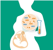 آزمایش سل فری DNA برای غربالگری و تشخیص ناهنجاری های جنینی و سندرم داون