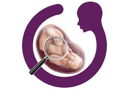 ارتباط بین ضخامت NT و شیوع نقایص کروموزومی، سقط ،مرگ جنین یا ناهنجاری های عمده جنین
