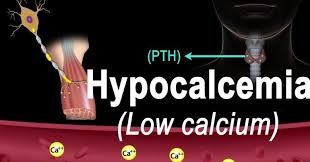 هیپوکلسمی یا کمبود کلسیم در بدن (Hypocalcaemia) 