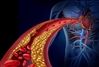 تشخیص حمله قلبی و سندرم حاد کرونری 